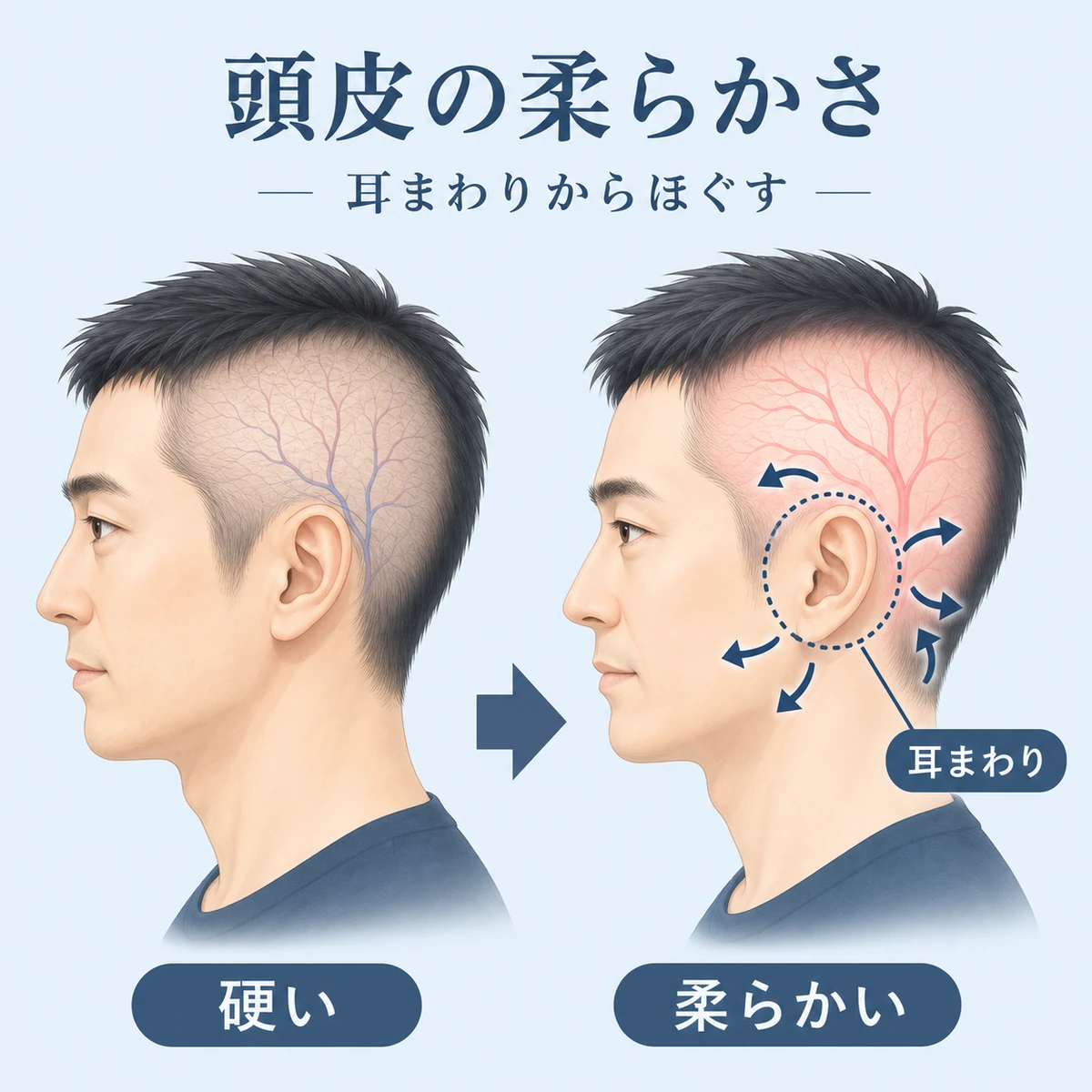 硬い頭皮と柔らかい頭皮を比べ耳まわりをほぐすコツを表した育毛イラスト