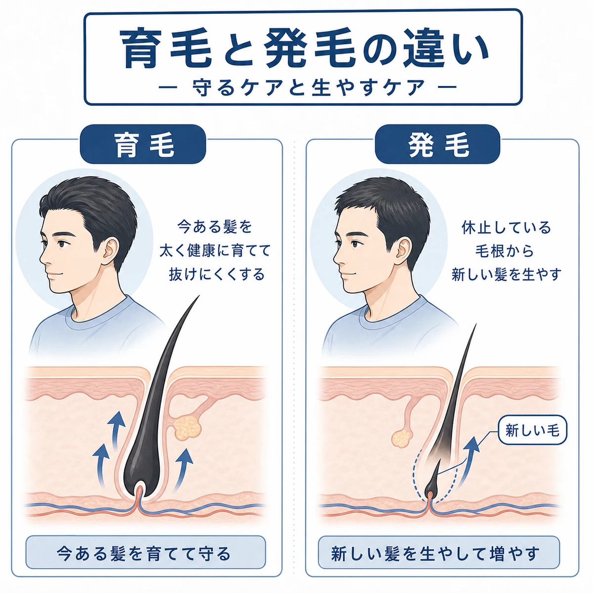 育毛剤と発毛剤の役割の違いを2つの毛根の断面図で対比した医療イラスト