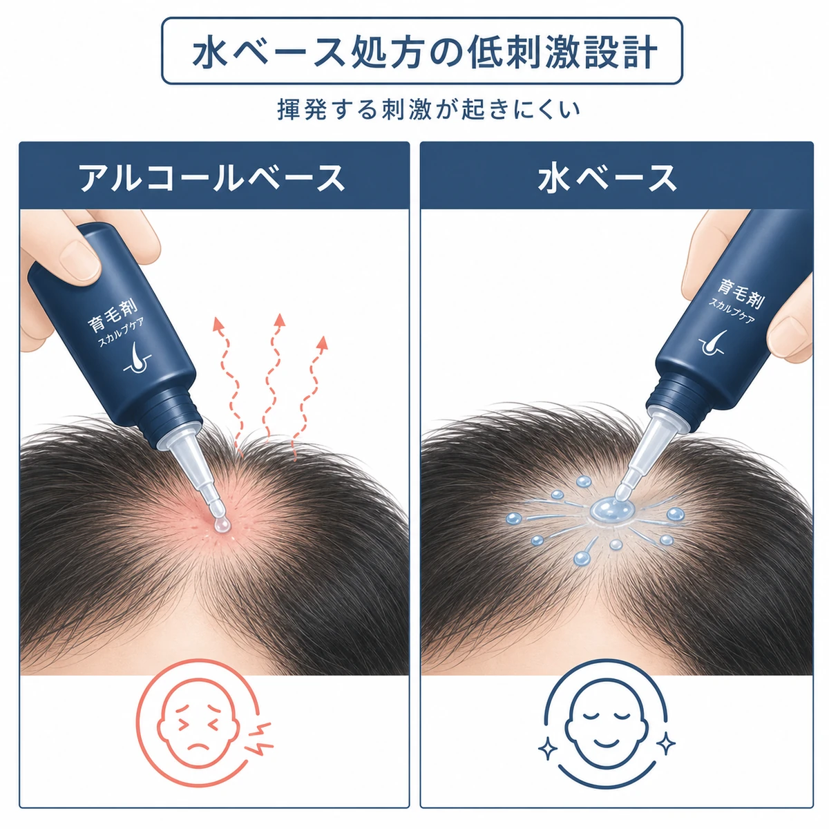 アルコールベースと水ベースの育毛剤を塗布時の刺激で比較した医療イラスト