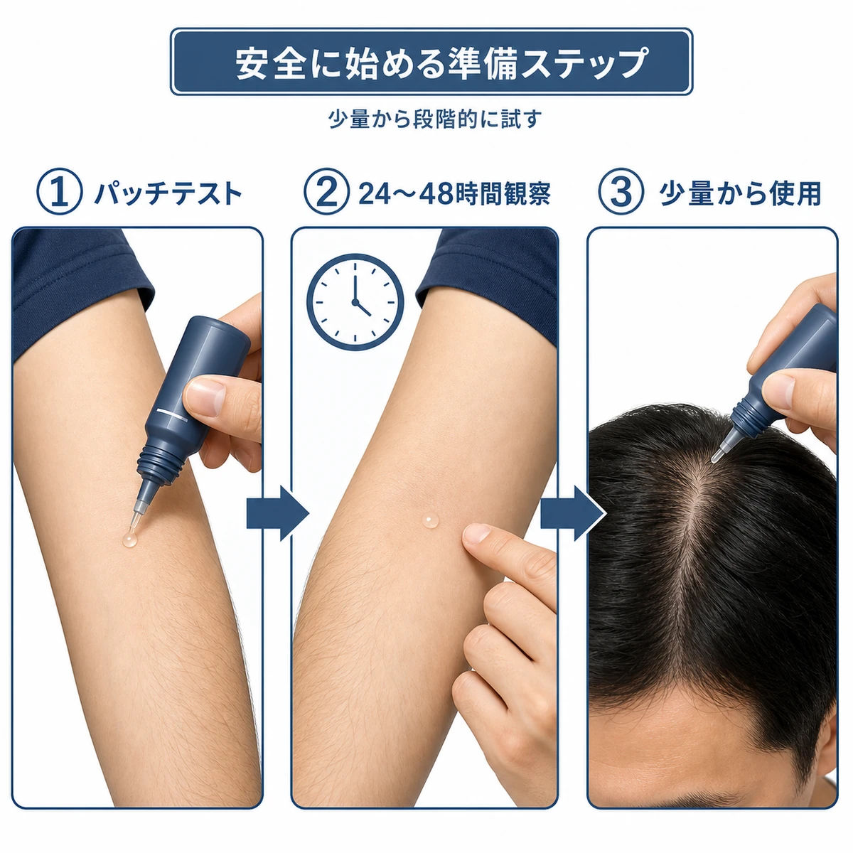 パッチテストから少量使用へ進む育毛剤の安全な始め方を段階的に示した医療イラスト