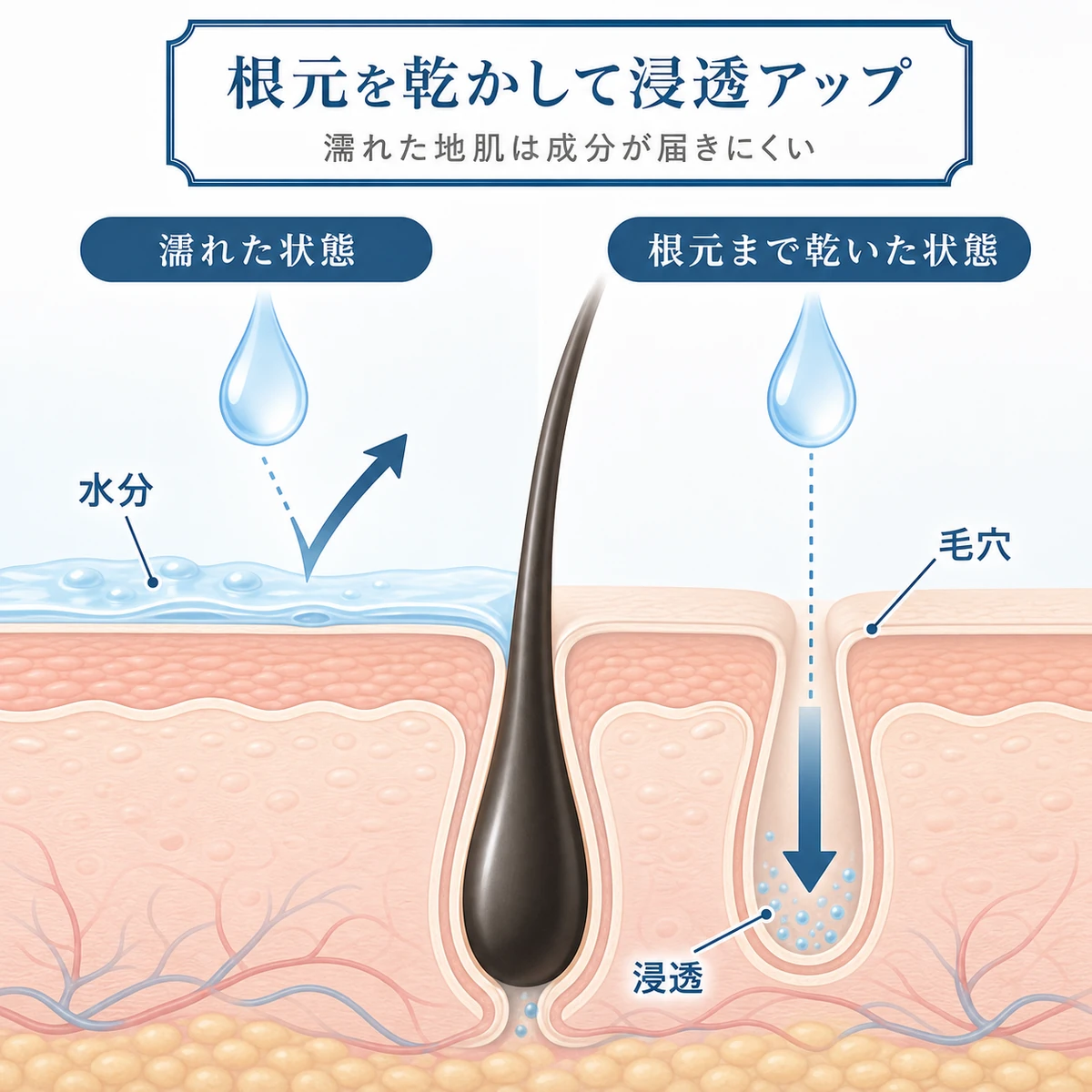 濡れた地肌と乾いた地肌で育毛剤の浸透が変わる仕組みを表した頭皮断面の医療イラスト