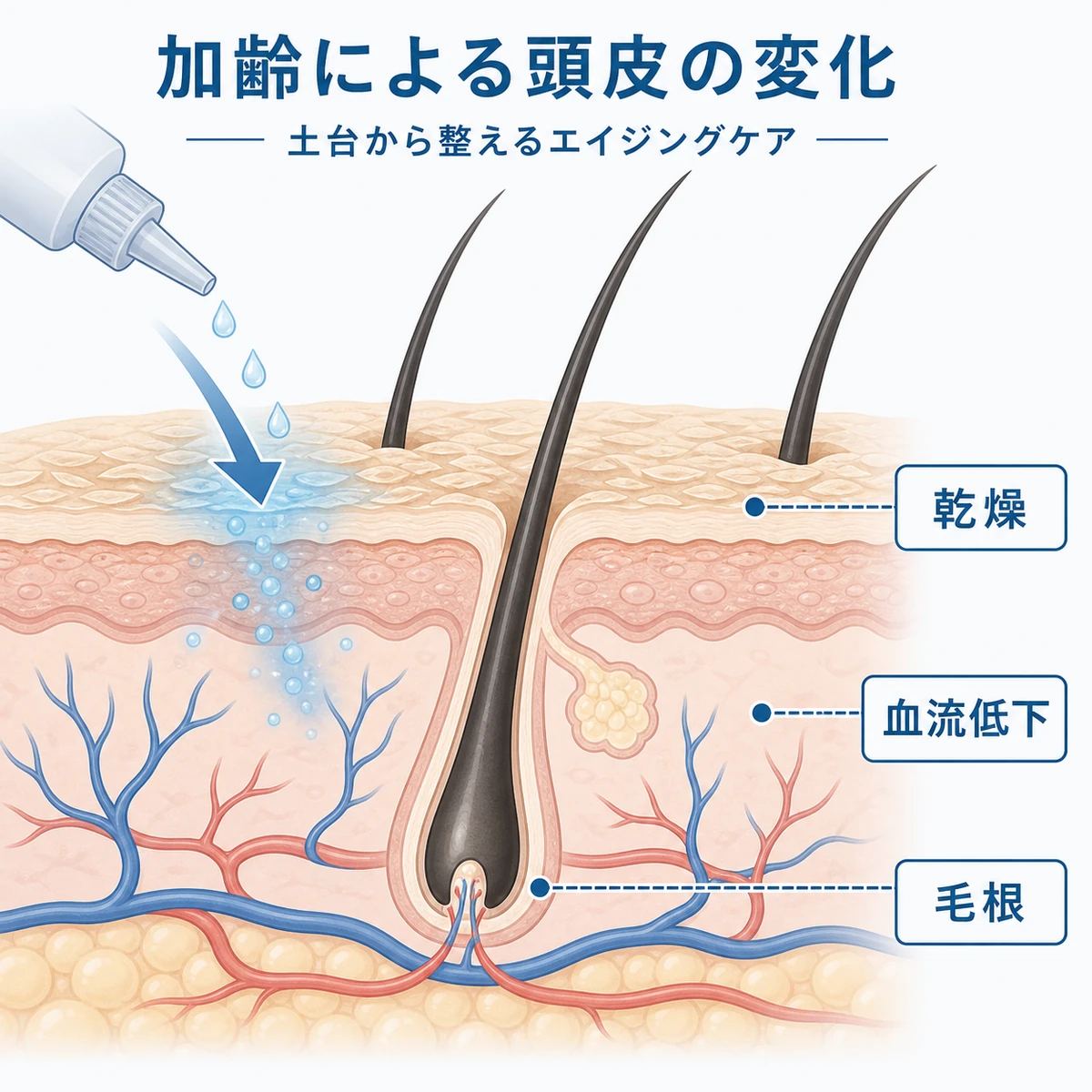 加齢で乾燥し血流が低下した頭皮の断面と育毛剤が環境を補う働きを表した医療イラスト