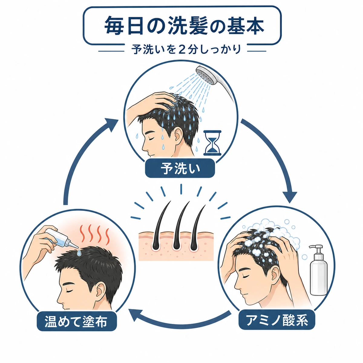予洗いとアミノ酸系洗浄と塗布のタイミングを円環で表した頭皮ケアの医療イラスト