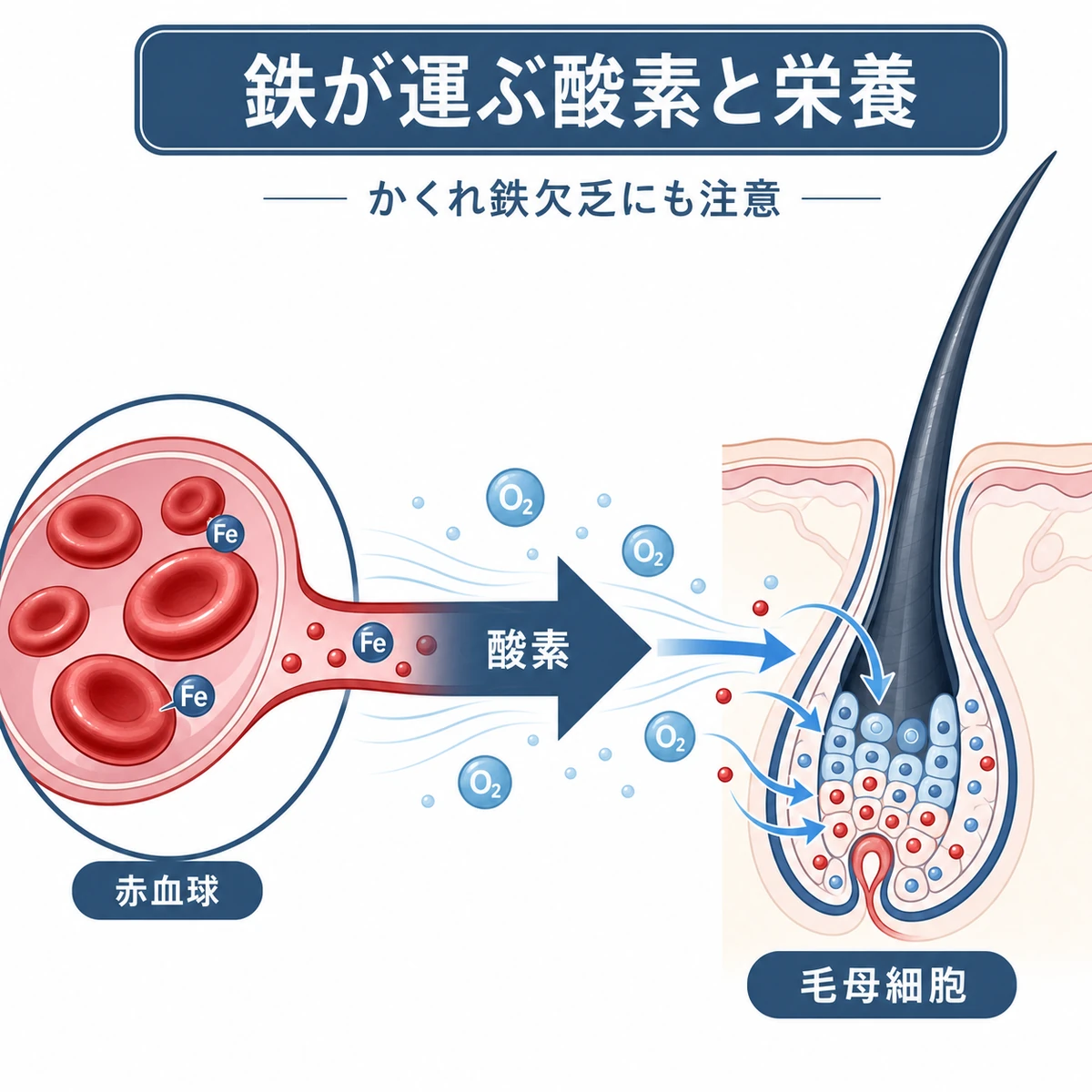 鉄が赤血球で酸素を運び毛母細胞へ栄養を届ける流れを表した医療イラスト