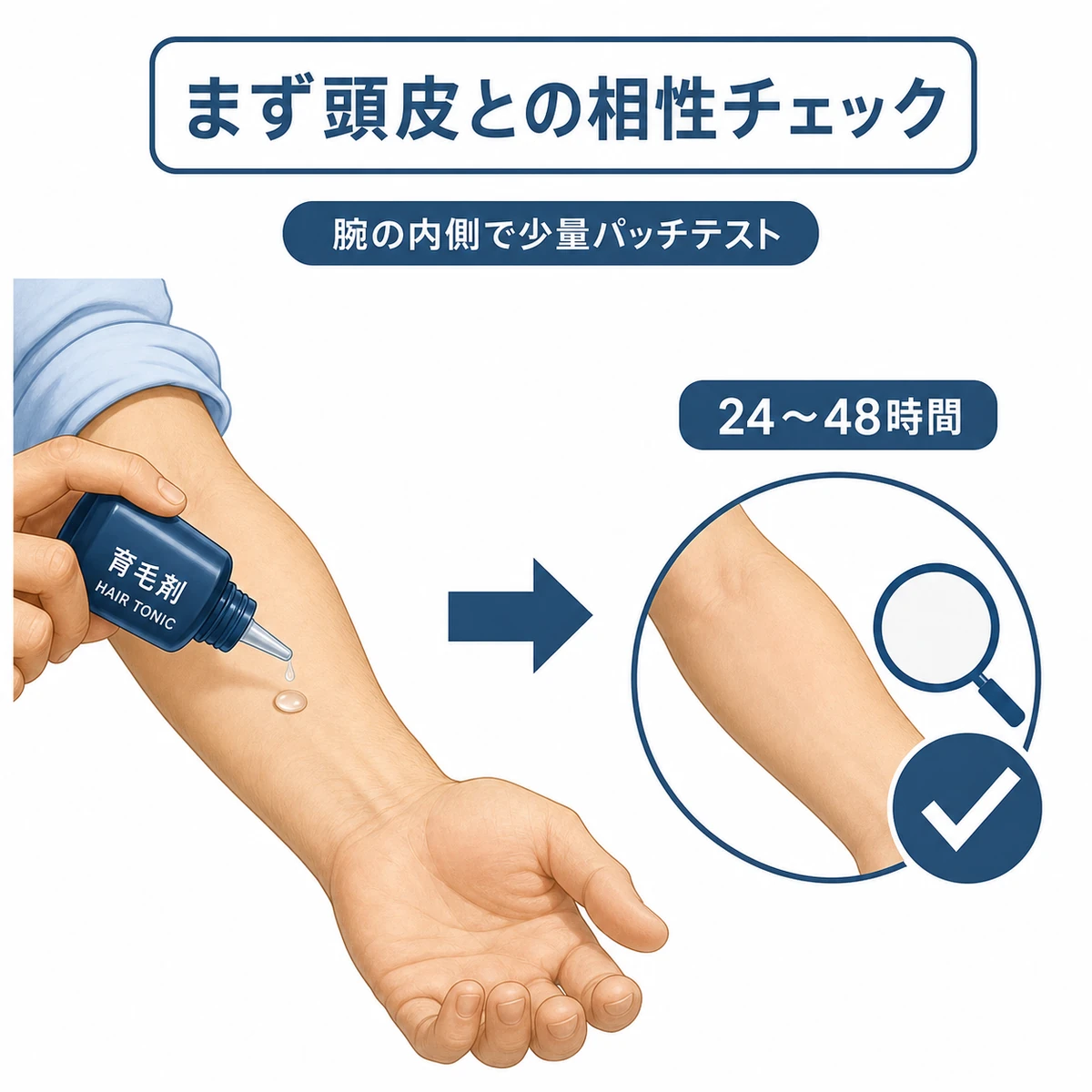 腕の内側で育毛剤のパッチテストを行い相性を確認する流れを示した医療イラスト