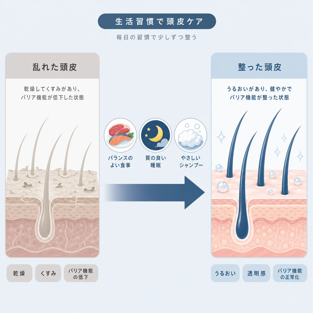 食事や睡眠、正しいシャンプーで頭皮環境が乱れた状態から整う変化を表した医療イラスト