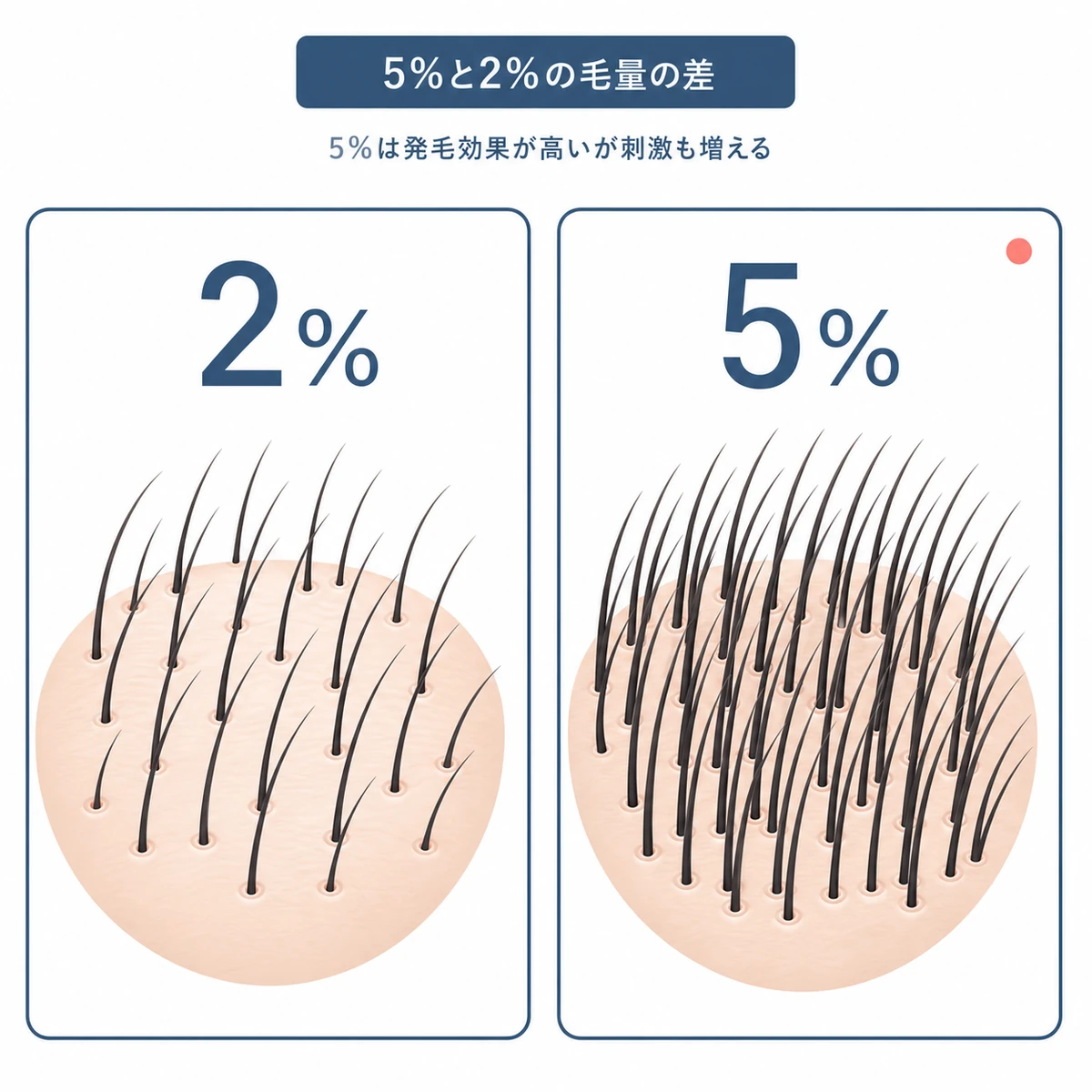 48週間の試験で5%が2%より毛量が多く増えた比較を左右2パネルで表した医療イラスト