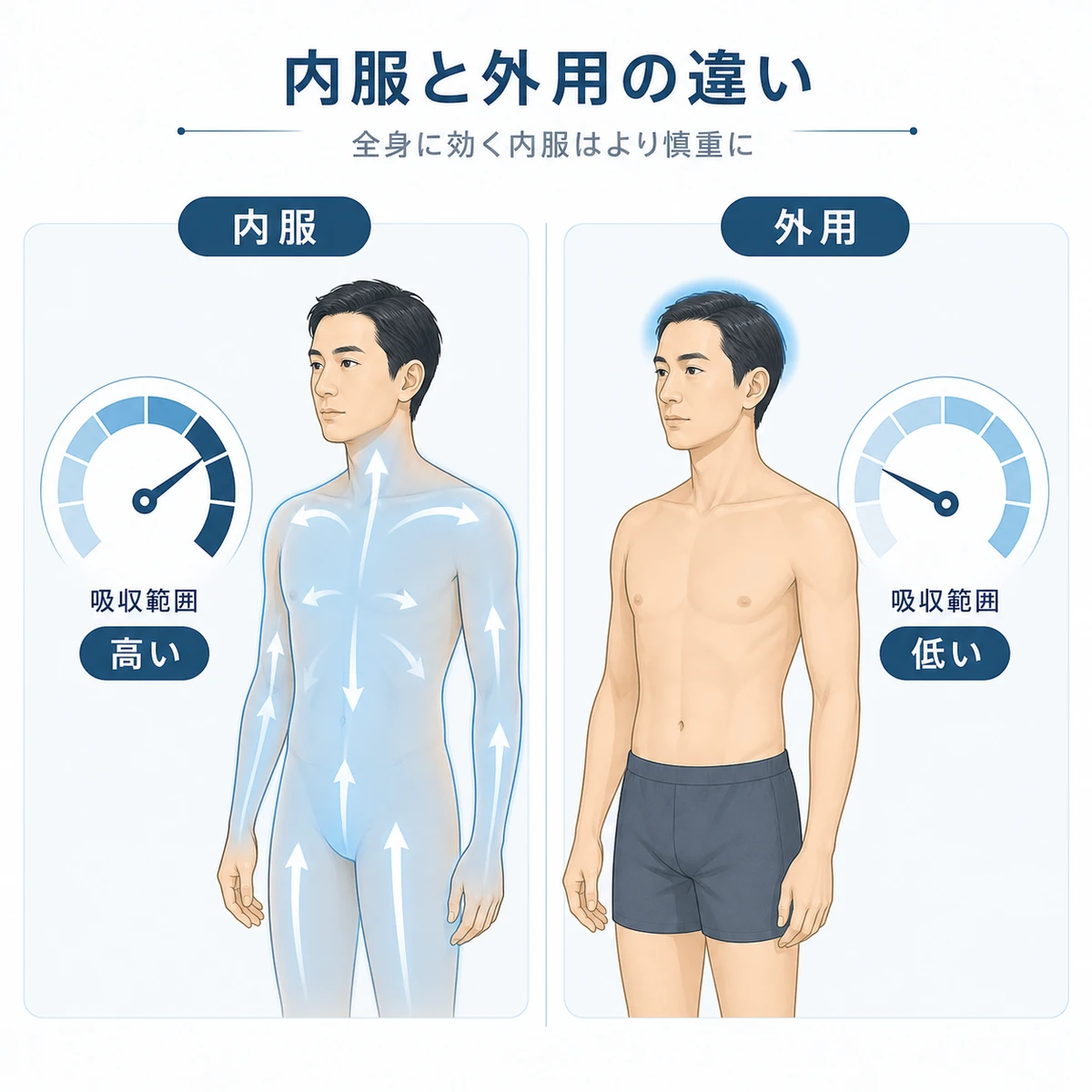 内服と外用のミノキシジルで体への広がり方が違うことを表した医療イラスト