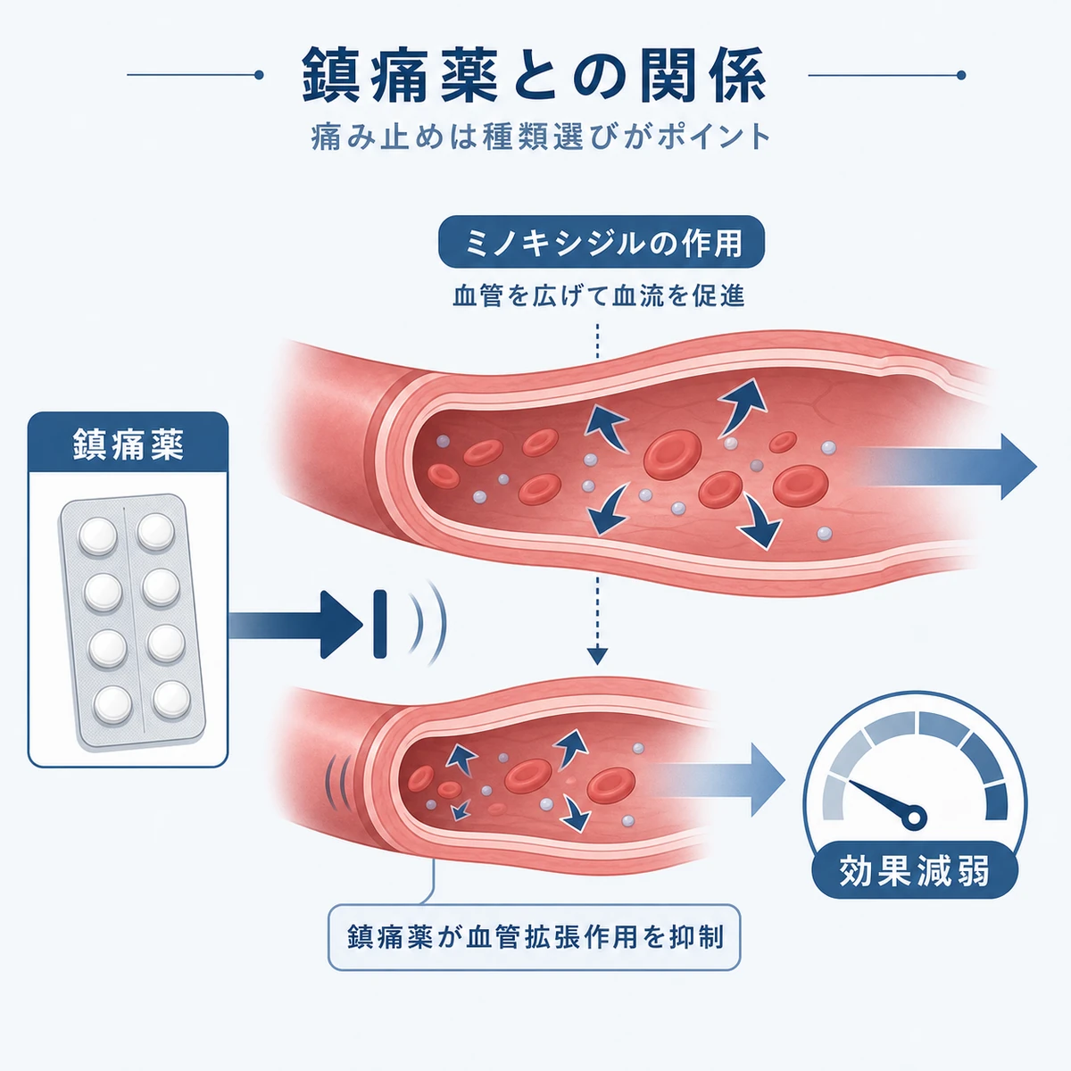 鎮痛薬がミノキシジルの血管への働きを弱める仕組みを表した医療イラスト