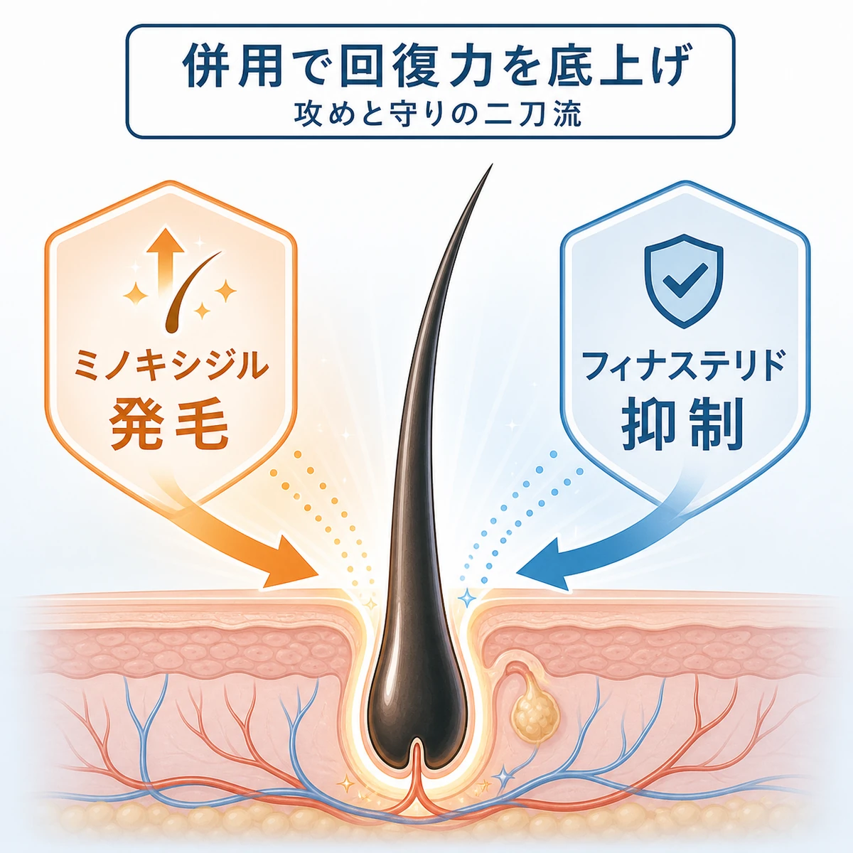 ミノキシジルとフィナステリドが発毛と抜け毛抑制の両面から働く併用のしくみを表した医療イラスト