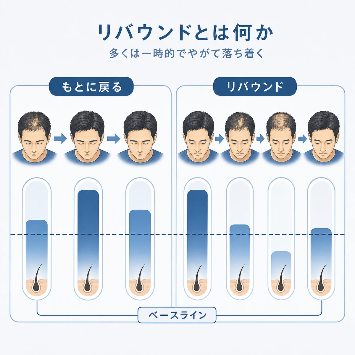 もとに戻る場合と一時的にベースラインを下回るリバウンドの違いを2つのゲージで対比した医療イラスト