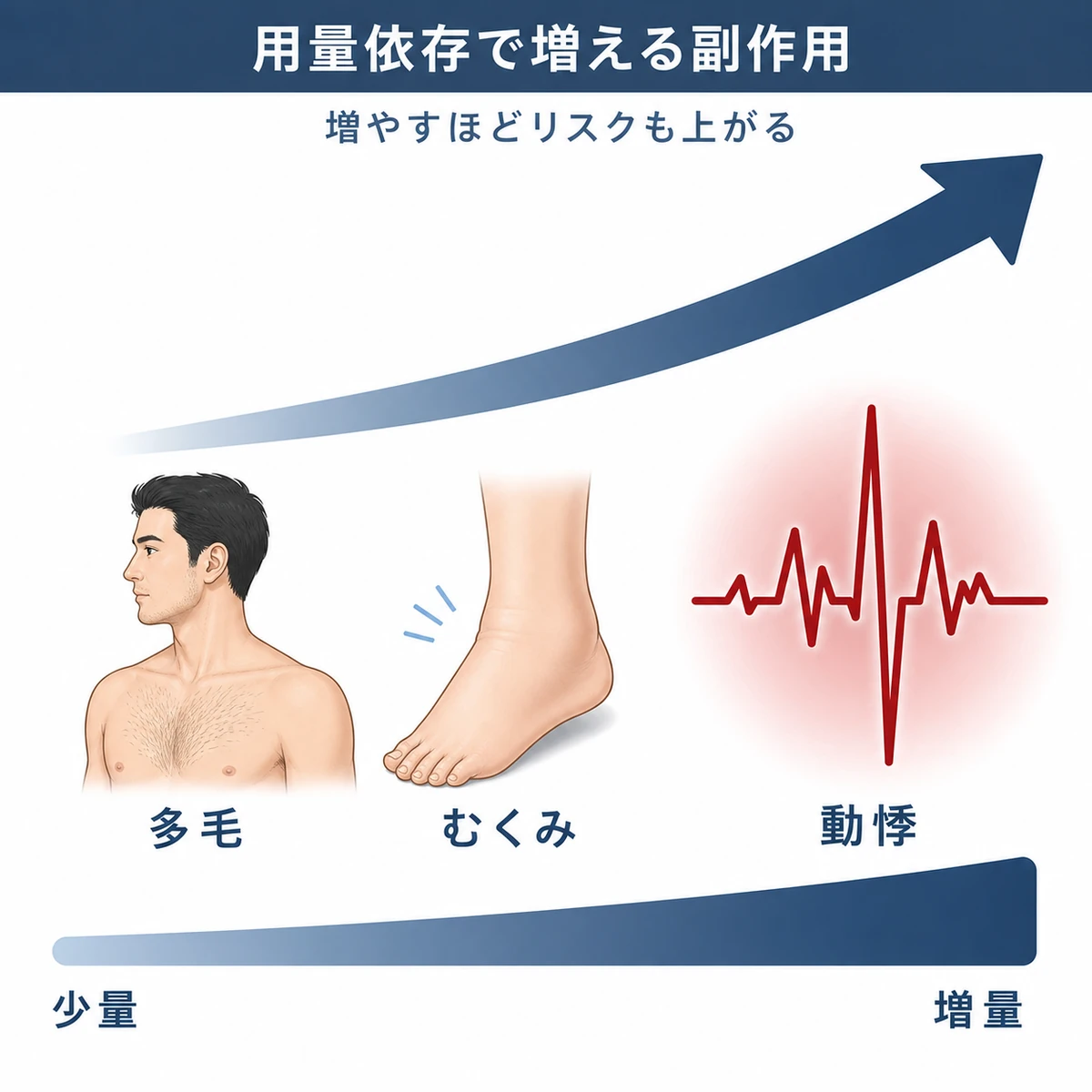 ミノキシジルの用量が増えるほど多毛やむくみ動悸の副作用が増える様子を段階的に表した医療イラスト