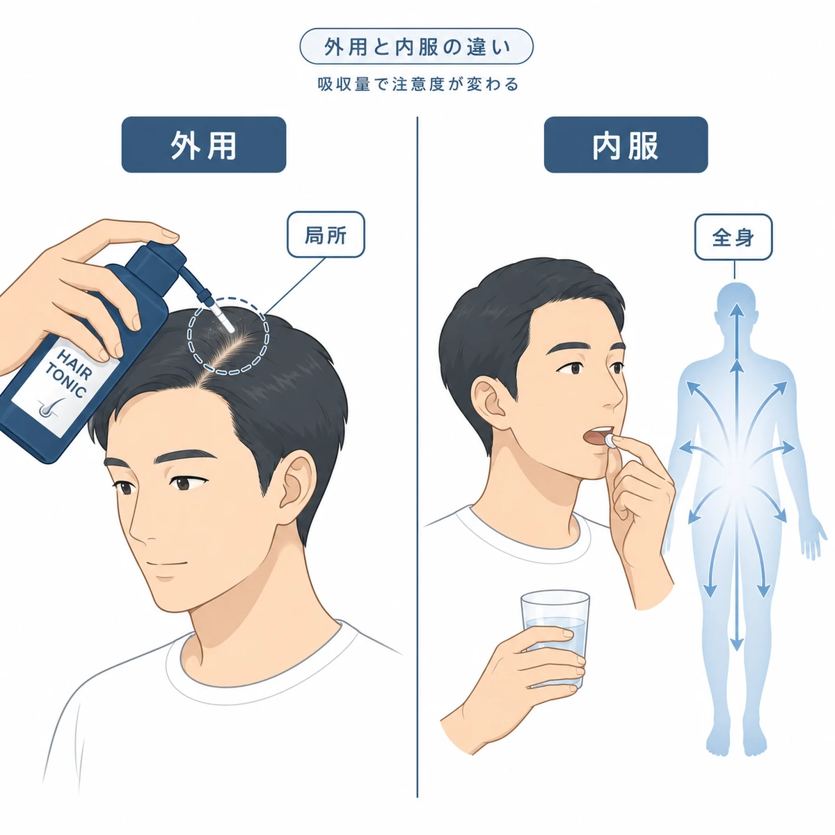 外用は頭皮局所、内服は全身に作用する違いを左右で比べた医療イラスト