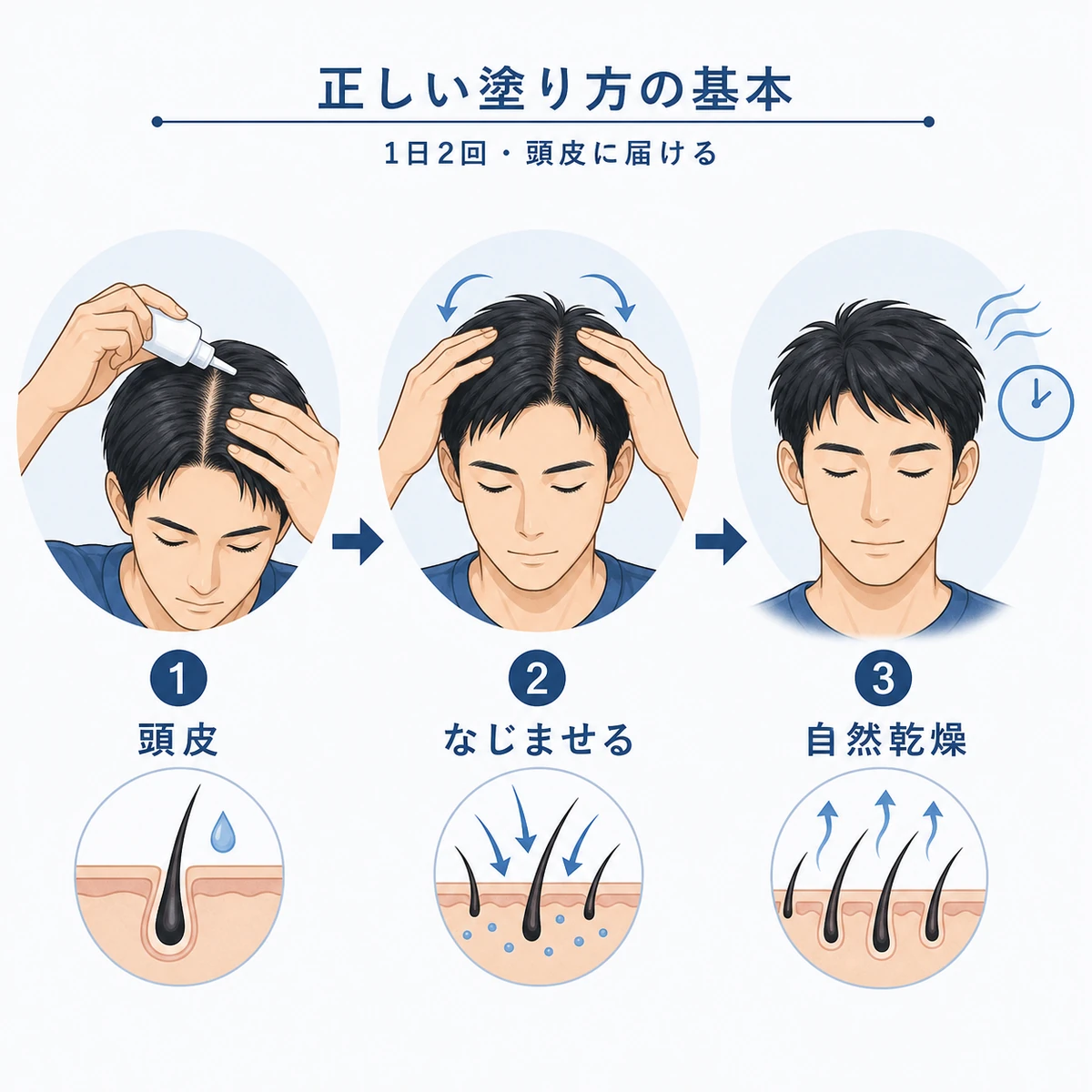 ミノキシジル外用薬を頭皮に正しく塗る手順を表した医療イラスト