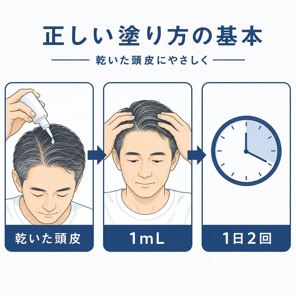 乾いた頭皮に適量を塗る外用ミノキシジルの正しい使い方を表した手順イラスト