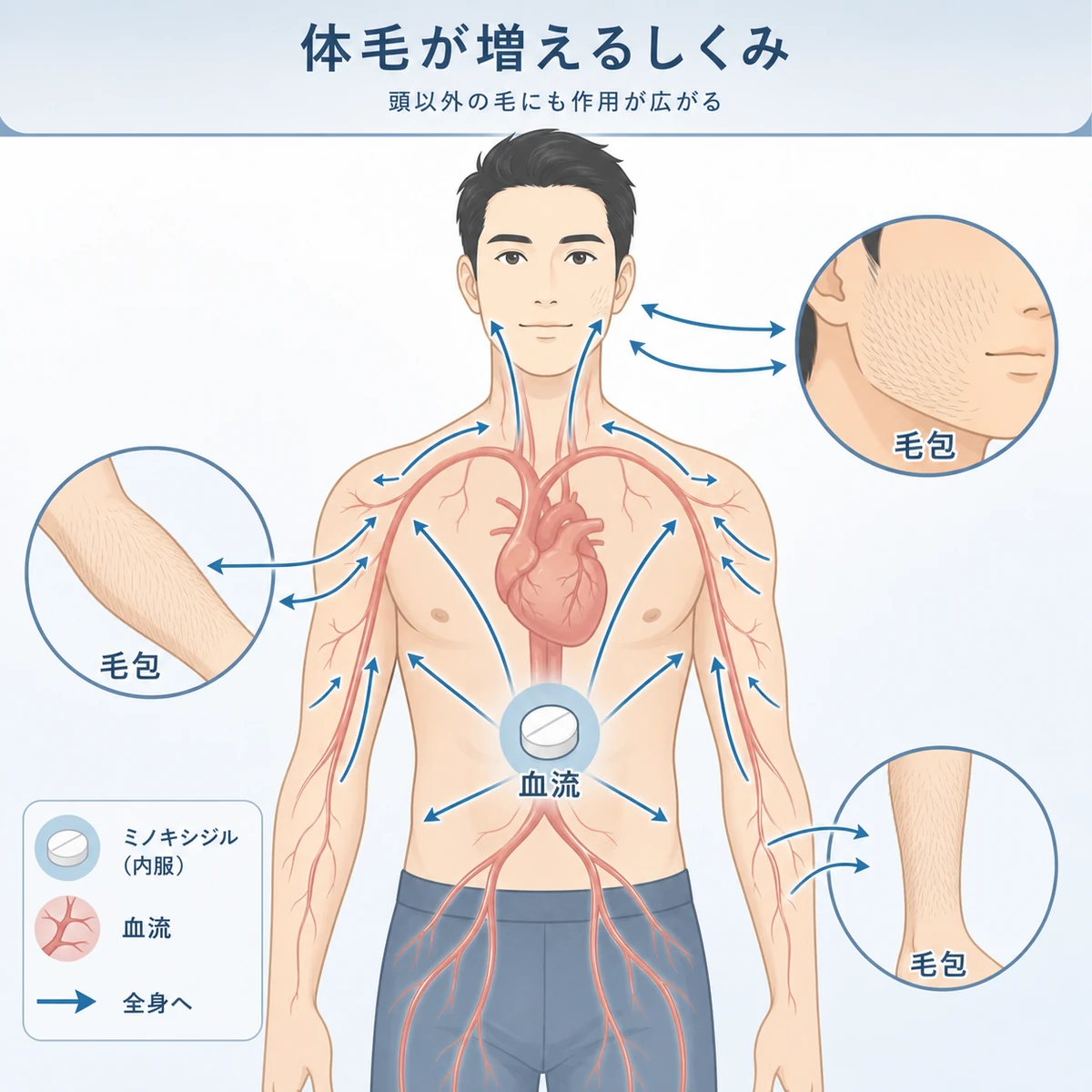 内服ミノキシジルの成分が血流で全身の毛包に届き体毛が増える仕組みを表した医療イラスト