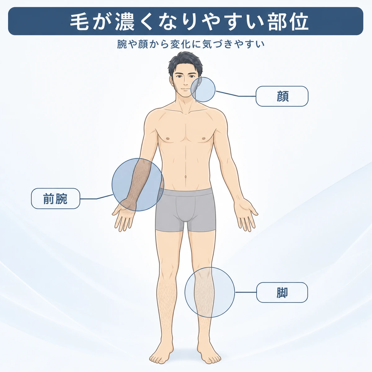 前腕や顔など多毛症が出やすい体の部位を成人男性の全身図で示した医療イラスト