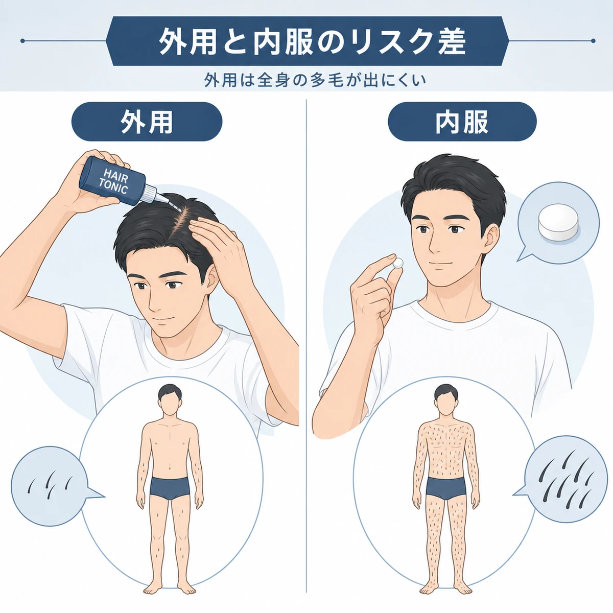 外用と内服ミノキシジルで多毛症リスクの大きさが違うことを左右で比べた医療イラスト