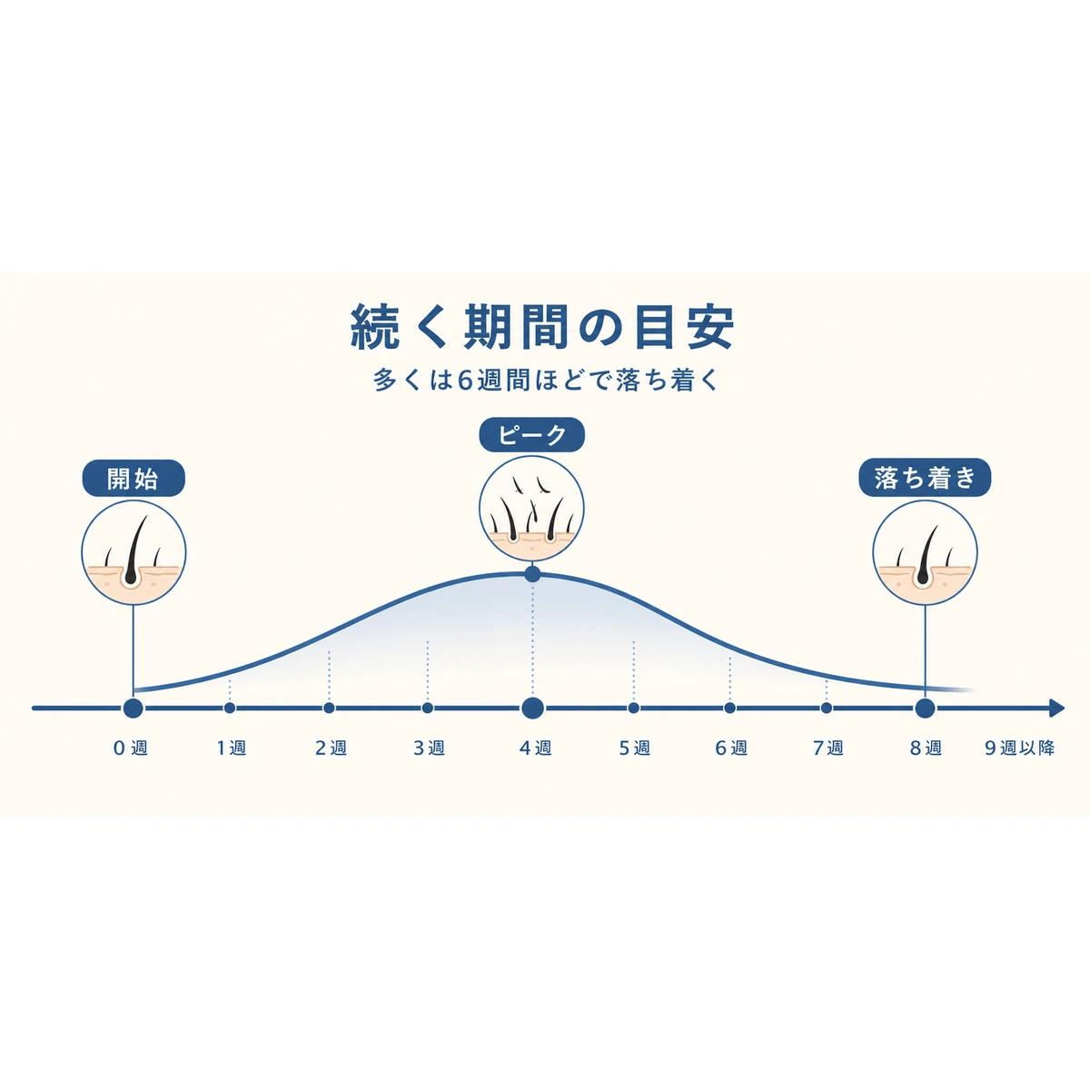 初期脱毛が始まってからピークを越えて落ち着くまでの期間の目安を表した医療イラスト