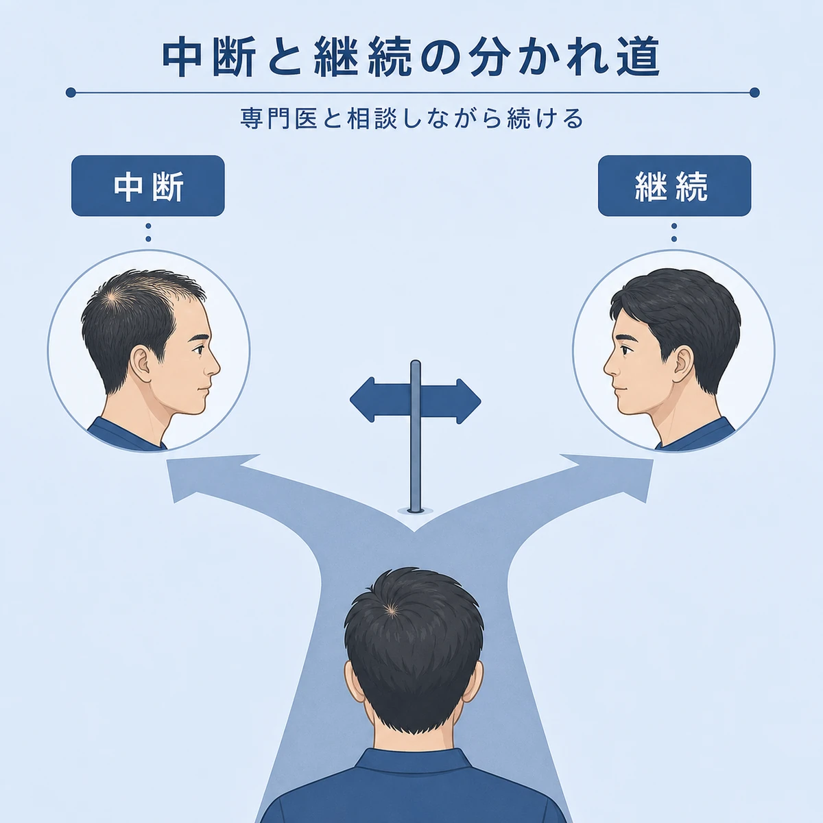 初期脱毛中に治療を続けた場合と中断した場合の違いを分かれ道で表した医療イラスト
