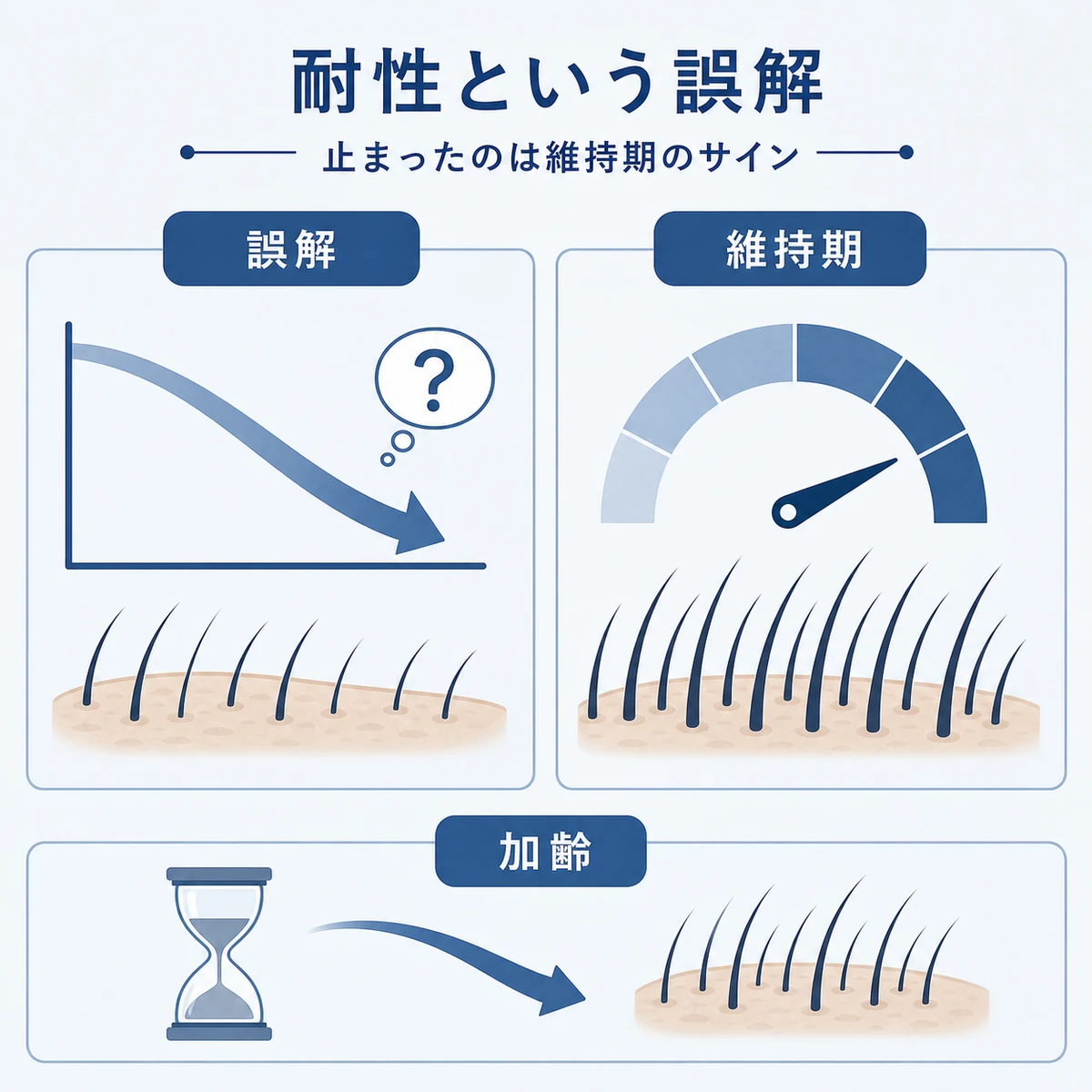 ミノキシジルの耐性という誤解と、毛量が維持期に達した実際の状態を左右で対比した医療イラスト
