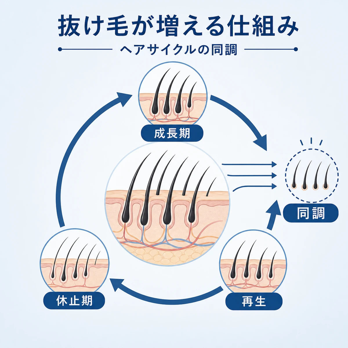 ヘアサイクルの同調現象で一時的に抜け毛が増える仕組みを円環の相関図で表した医療イラスト
