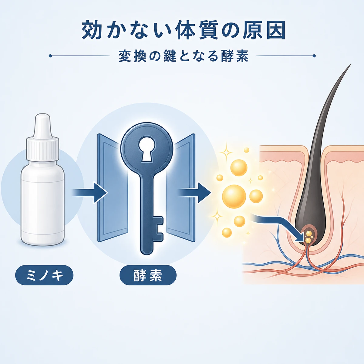 ミノキシジルが硫酸転移酵素によって活性型に変換される仕組みを表した医療イラスト