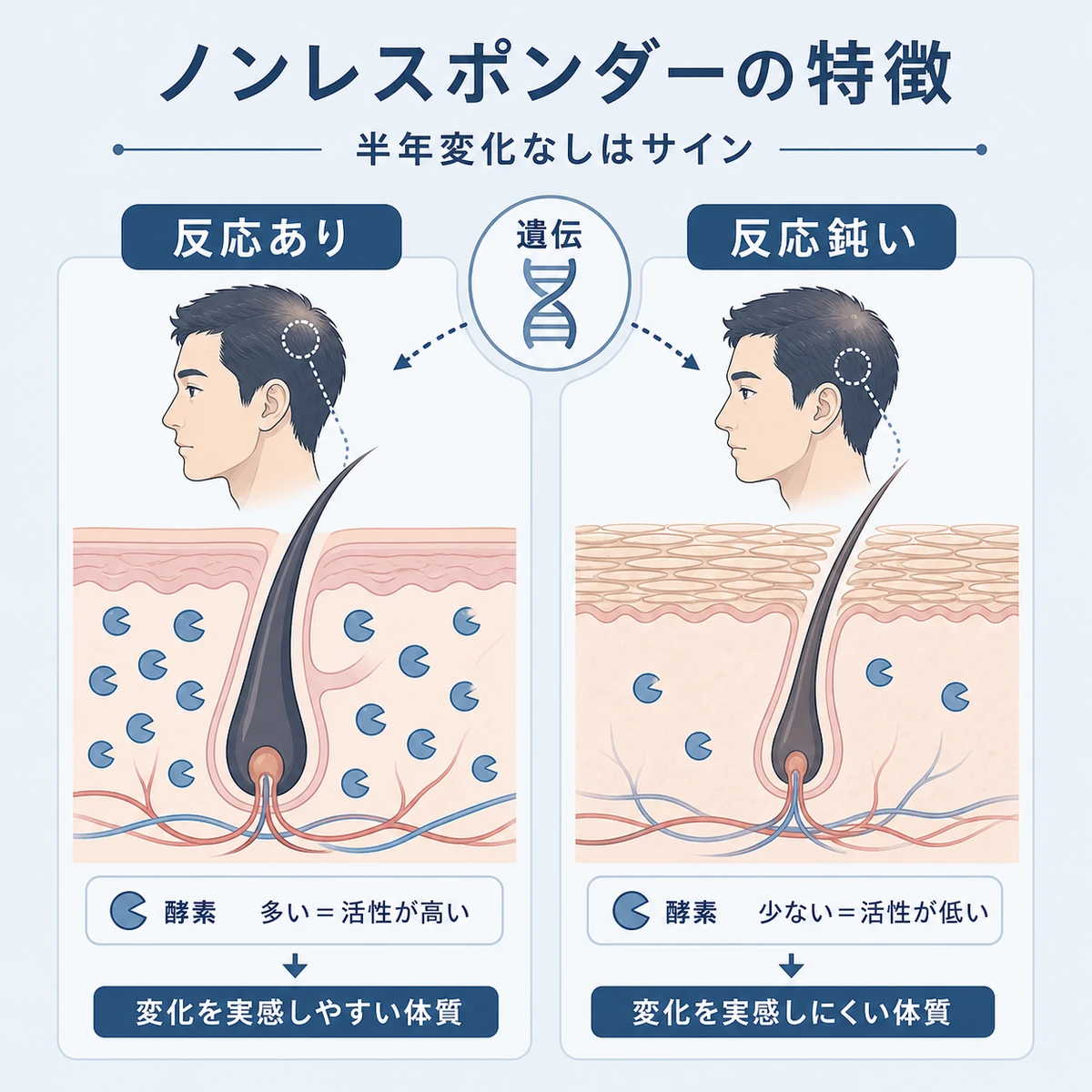 反応する体質とノンレスポンダーの頭皮の違いを左右で比較した医療イラスト