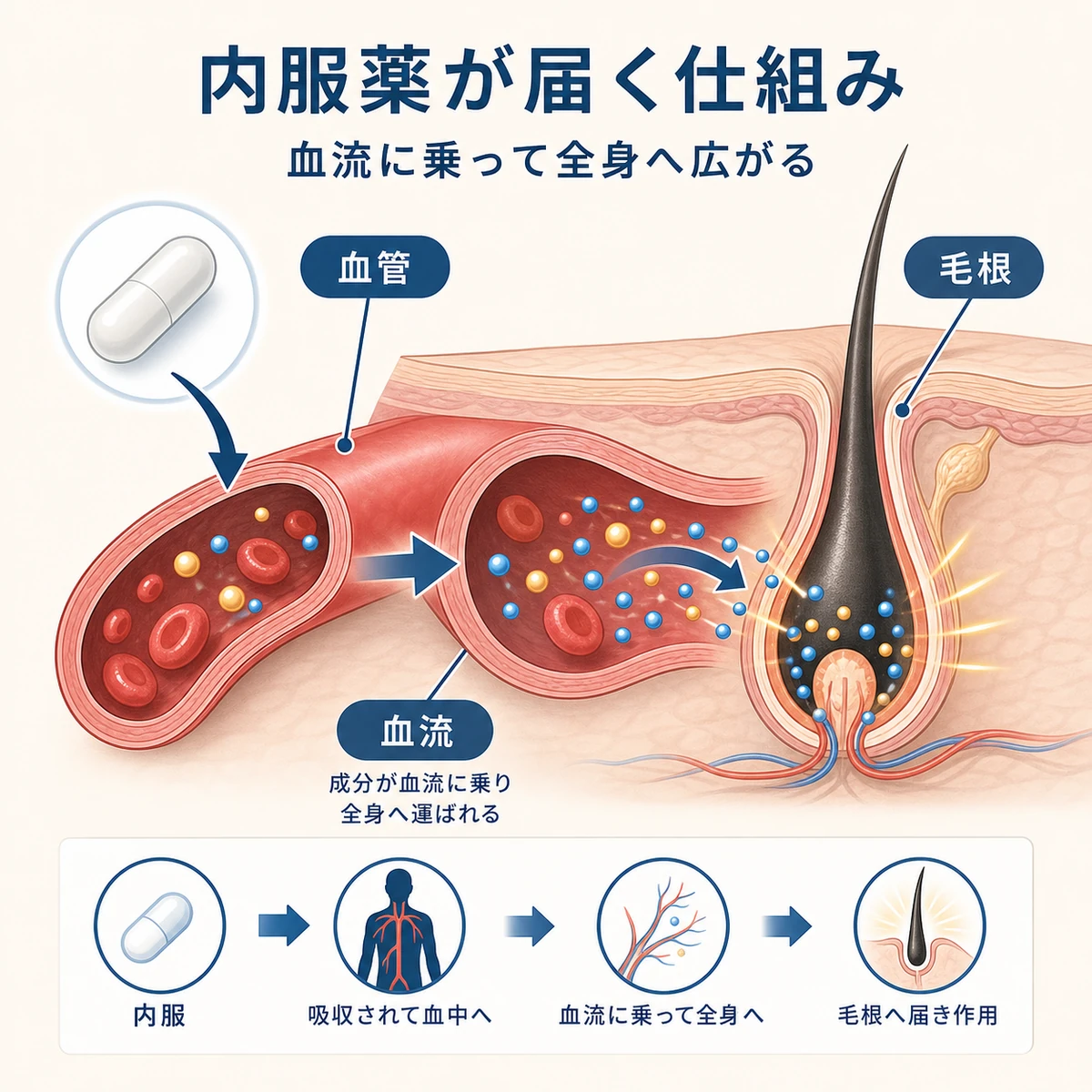 内服したミノキシジルが血流に乗って毛根へ栄養を届ける仕組みを表した医療イラスト