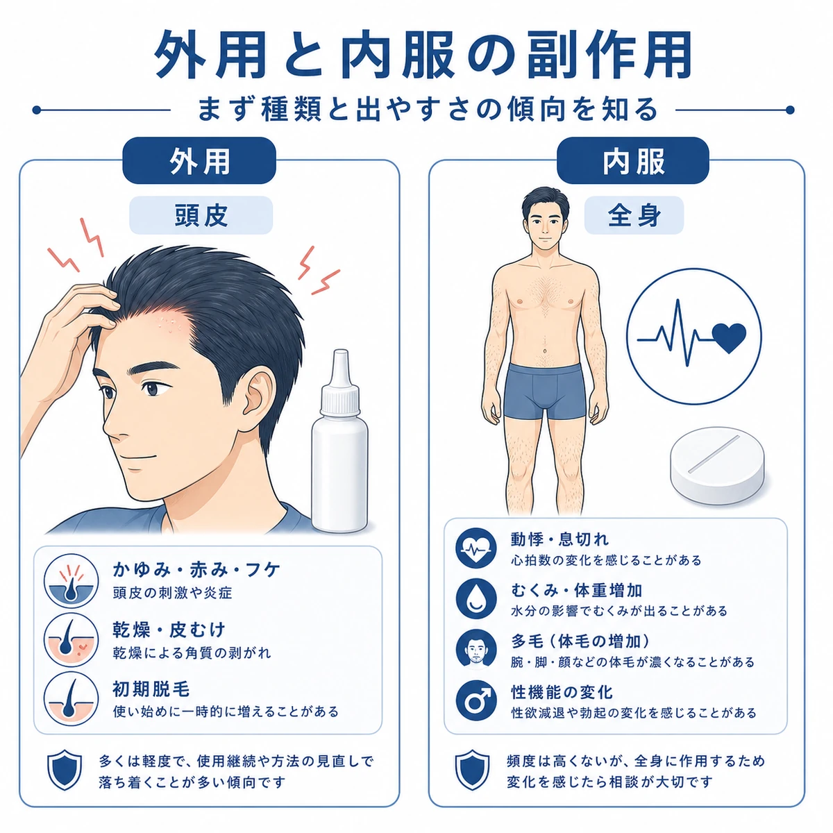 外用と内服で異なるミノキシジルの副作用を左右に対比した医療イラスト
