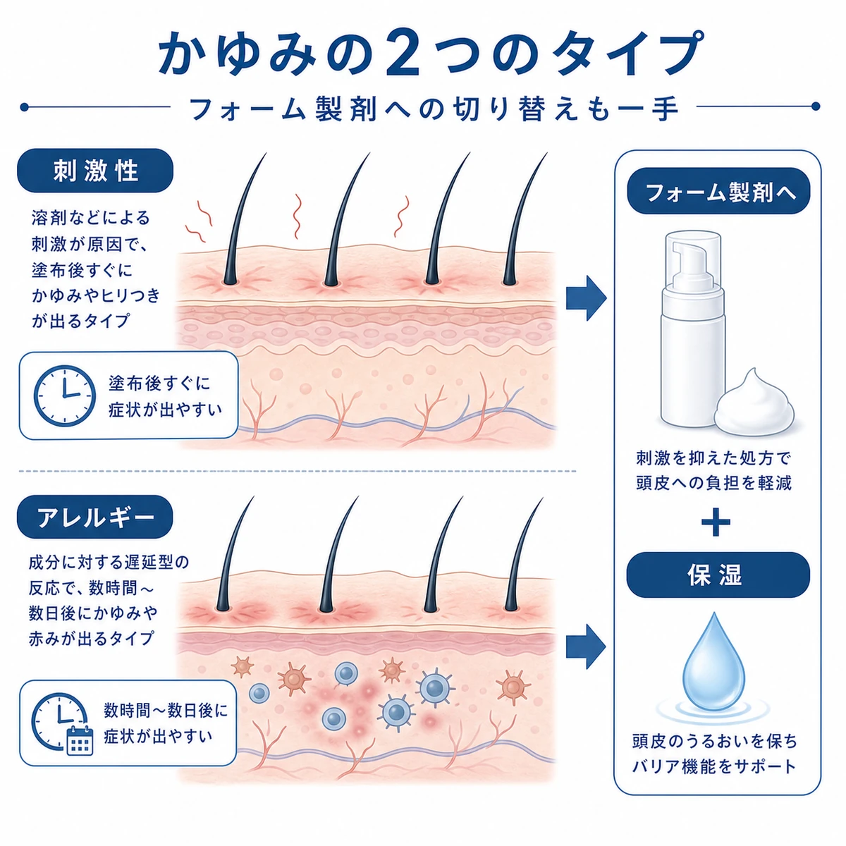刺激性とアレルギー性の2タイプに分けた頭皮のかゆみを表した医療イラスト