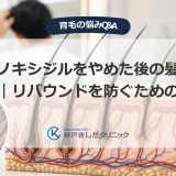 ミノキシジルをやめた後の髪の変化｜リバウンドを防ぐための知識