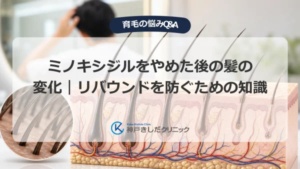 ミノキシジルをやめた後の髪の変化｜リバウンドを防ぐための知識