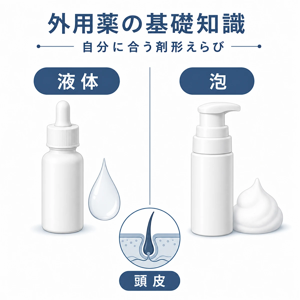 外用ミノキシジルの液体タイプとフォームタイプの違いを対比した医療イラスト