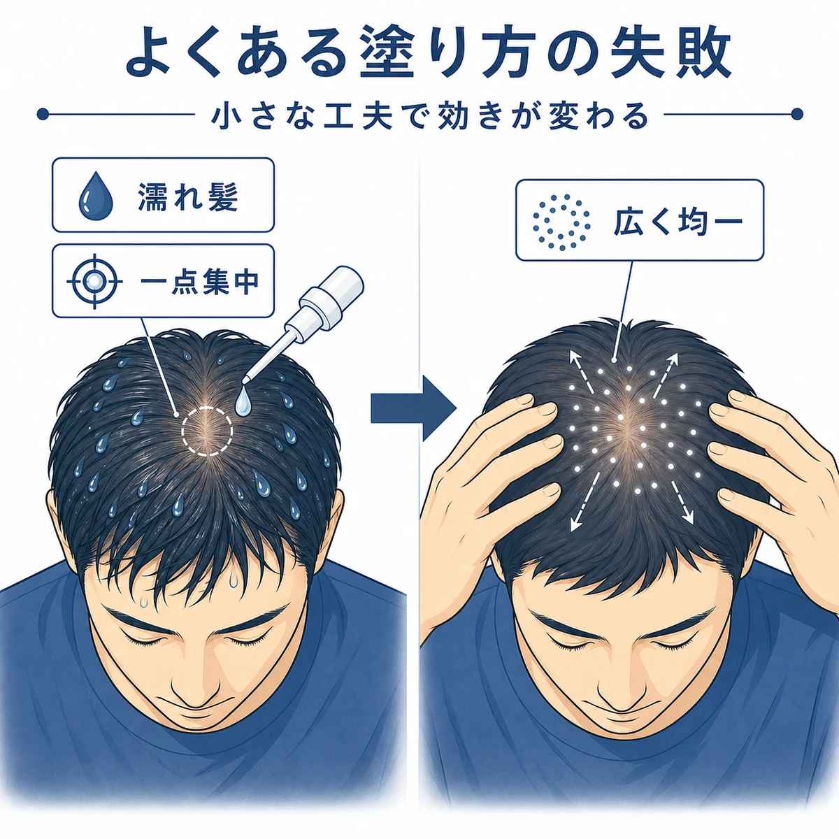 髪が濡れたまま塗る失敗と乾いた頭皮に均一に塗る正しい方法を対比した医療イラスト