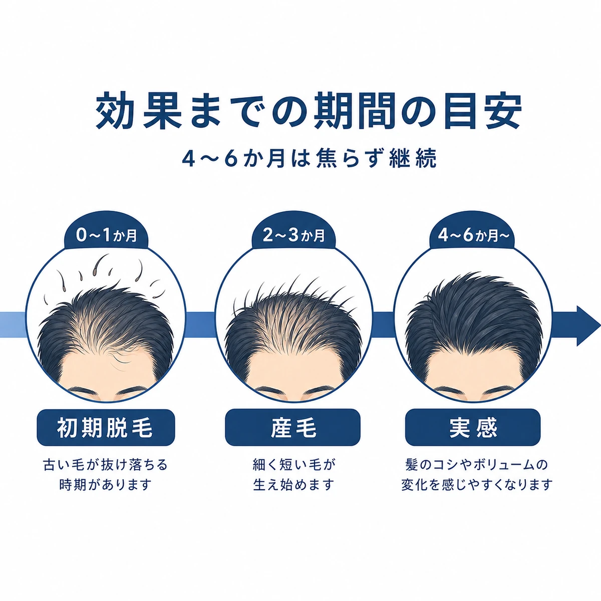 初期脱毛から産毛、実感までの効果が出るまでの経過の目安を示した医療イラスト