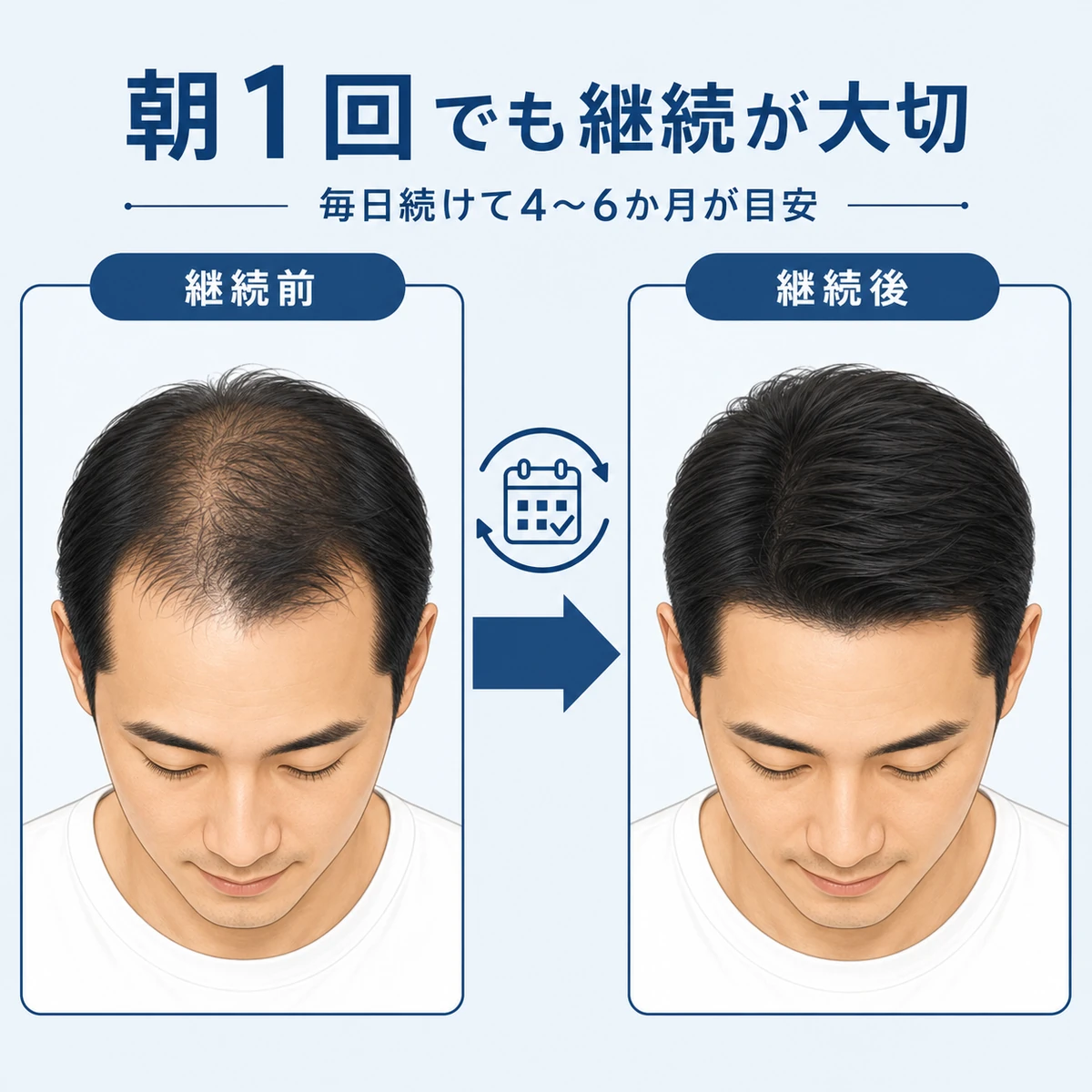 毎日の継続前と継続後を左から右へ穏やかに並べた朝1回の育毛ケアの医療イラスト