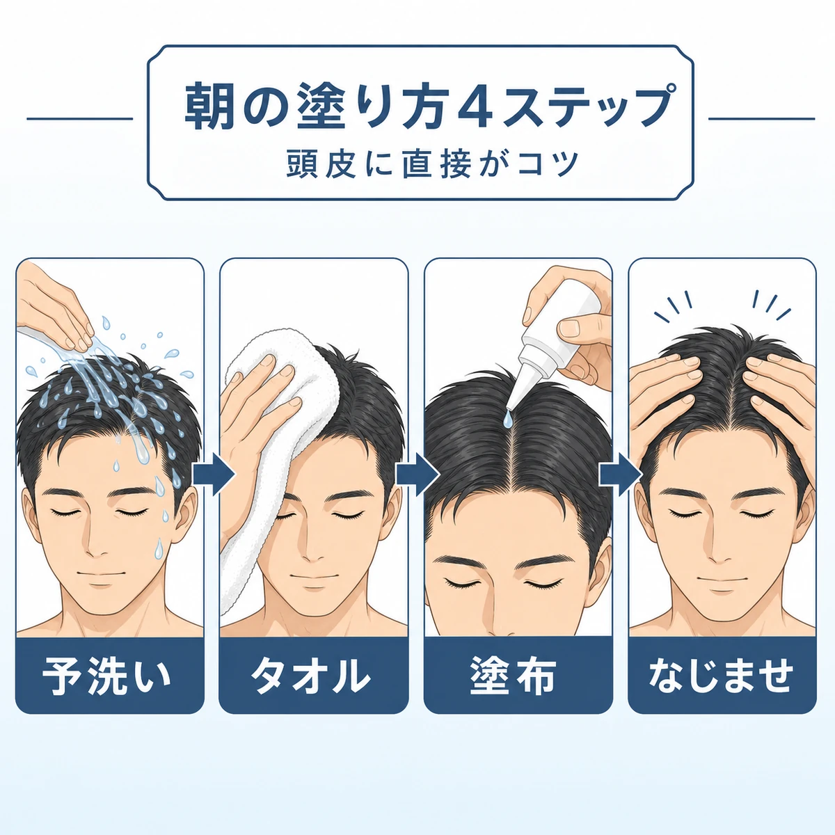朝の育毛剤の塗り方を予洗いからなじませまで4つの手順で示した医療イラスト