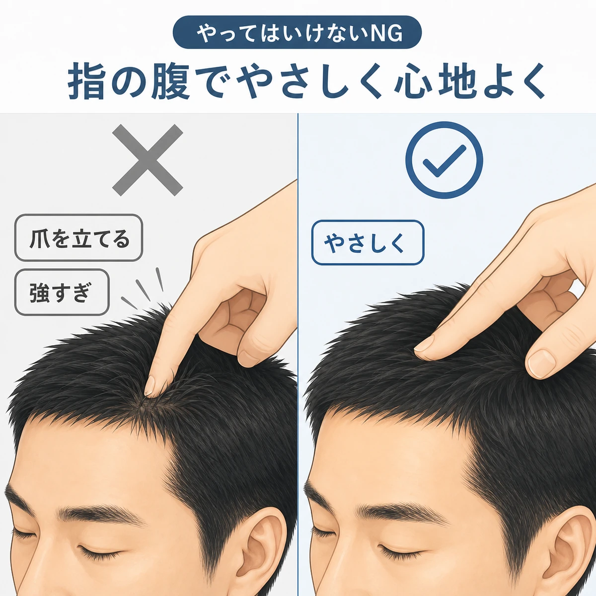 爪を立てる強すぎる圧を避け指の腹でやさしく行う頭皮マッサージのNGと良い例を対比した医療イラスト