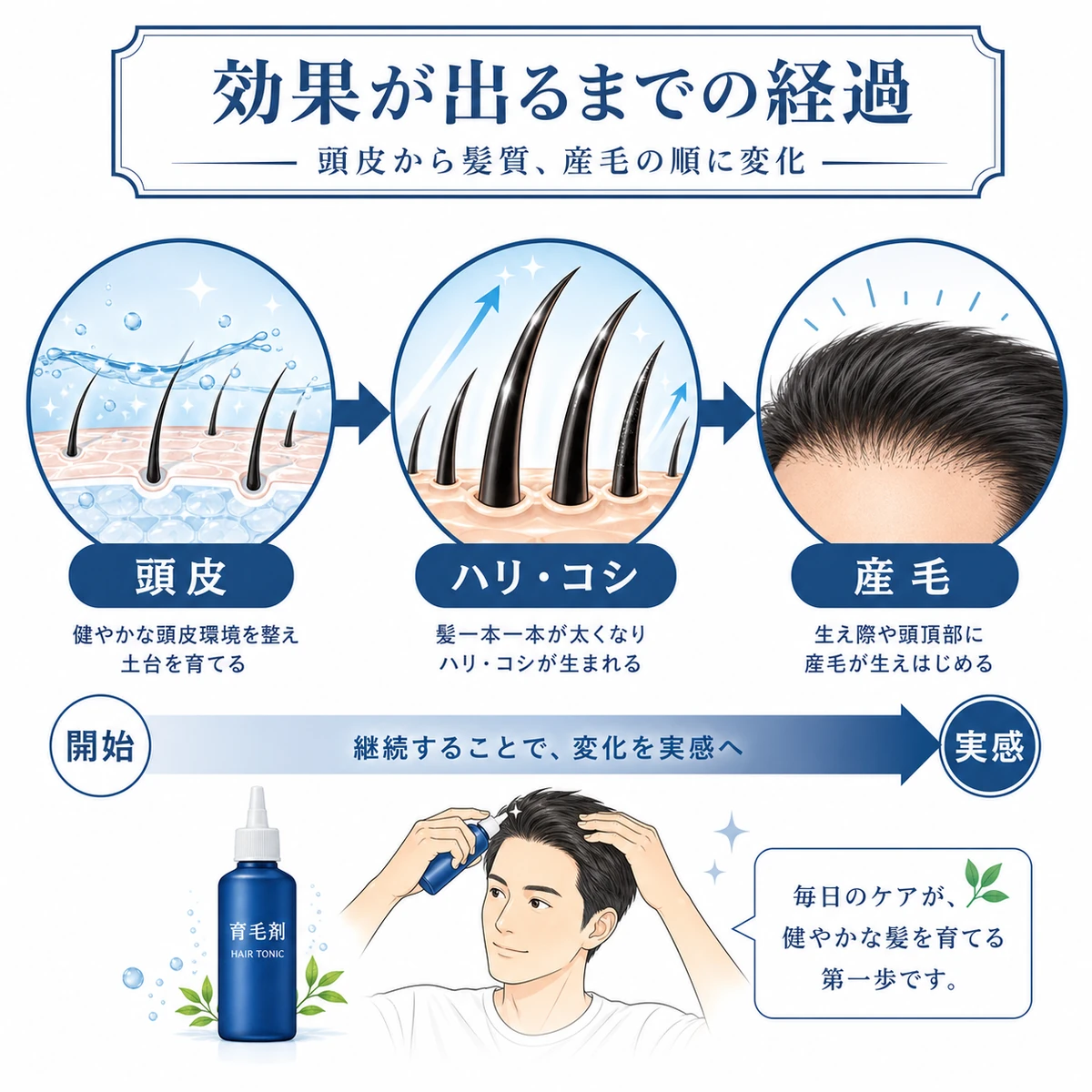 頭皮環境から髪質、産毛へと順に現れる育毛剤の効果の経過を表した医療イラスト