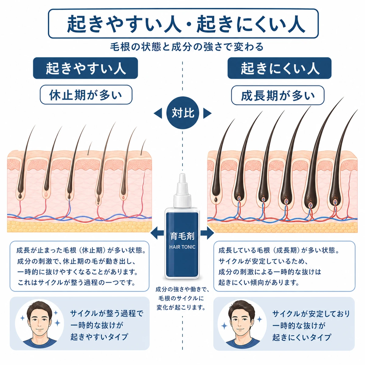 初期脱毛が起きやすい人と起きにくい人の毛根の状態の違いを対比した医療イラスト