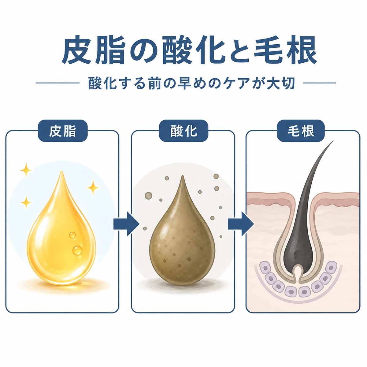 皮脂が酸化して毛根にダメージが及ぶまでの流れを段階的に描いた医療イラスト