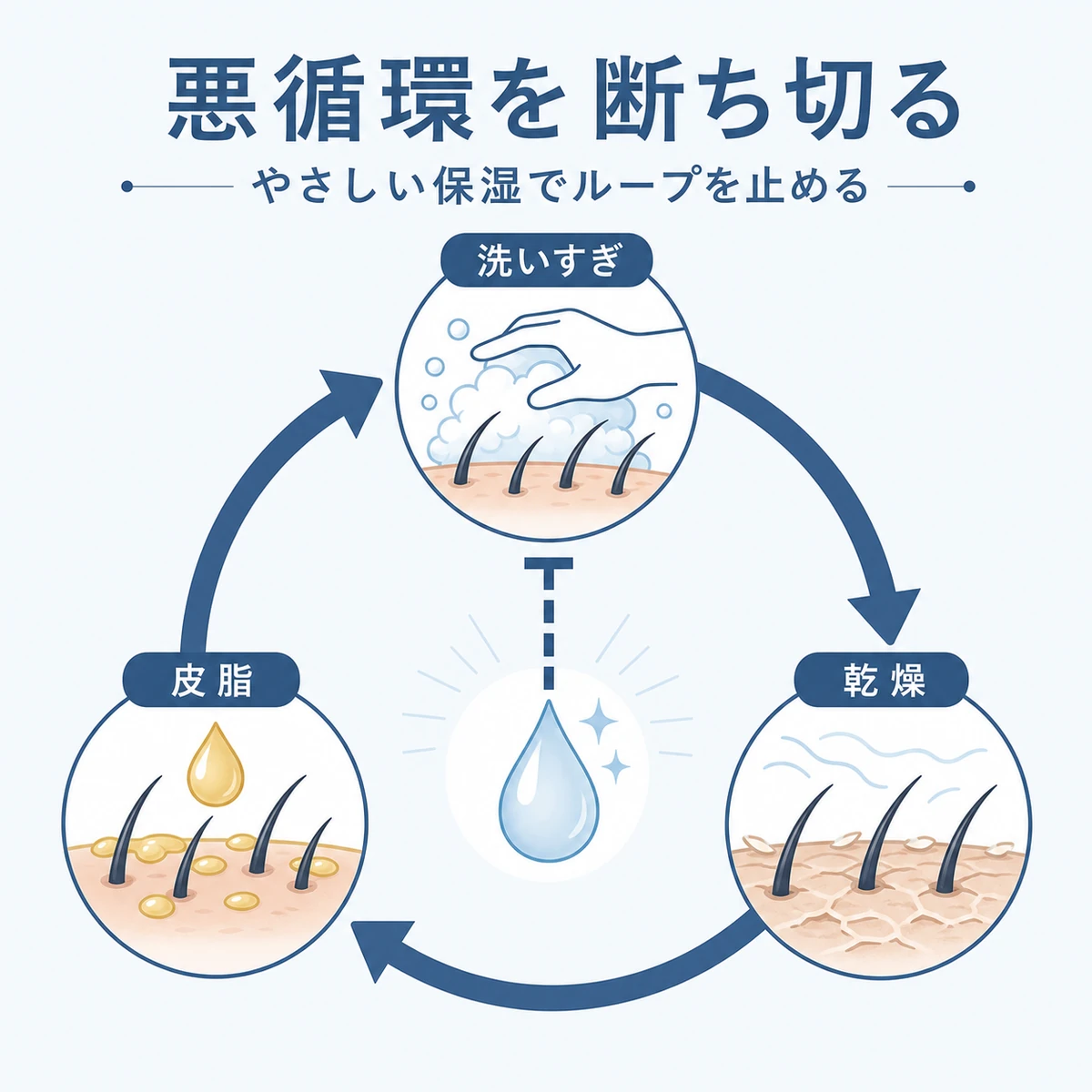 洗いすぎと乾燥と皮脂の悪循環を保湿で断ち切る流れを円環で描いた医療イラスト