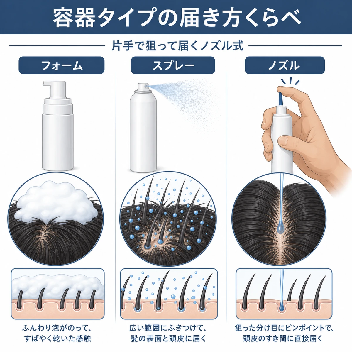 フォーム式とスプレー式とノズル式で頭皮への届き方が異なる様子を並べて比べた育毛イラスト