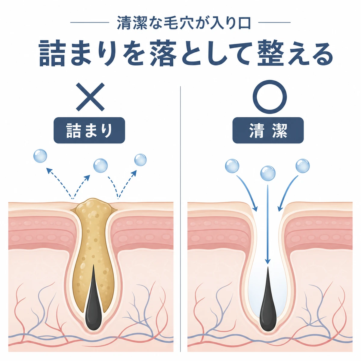 皮脂で詰まった毛穴と清潔な毛穴で育毛成分の入りやすさが違うことを表した医療イラスト