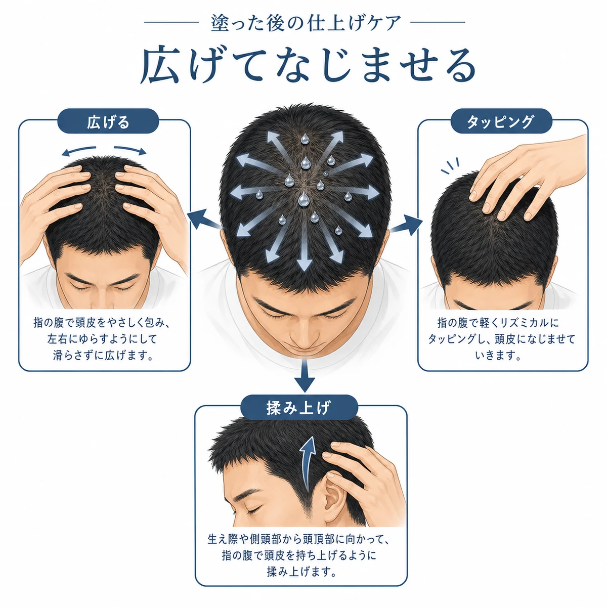 育毛剤を塗った後の仕上げマッサージで成分を頭皮全体へ広げる動きを表した医療イラスト