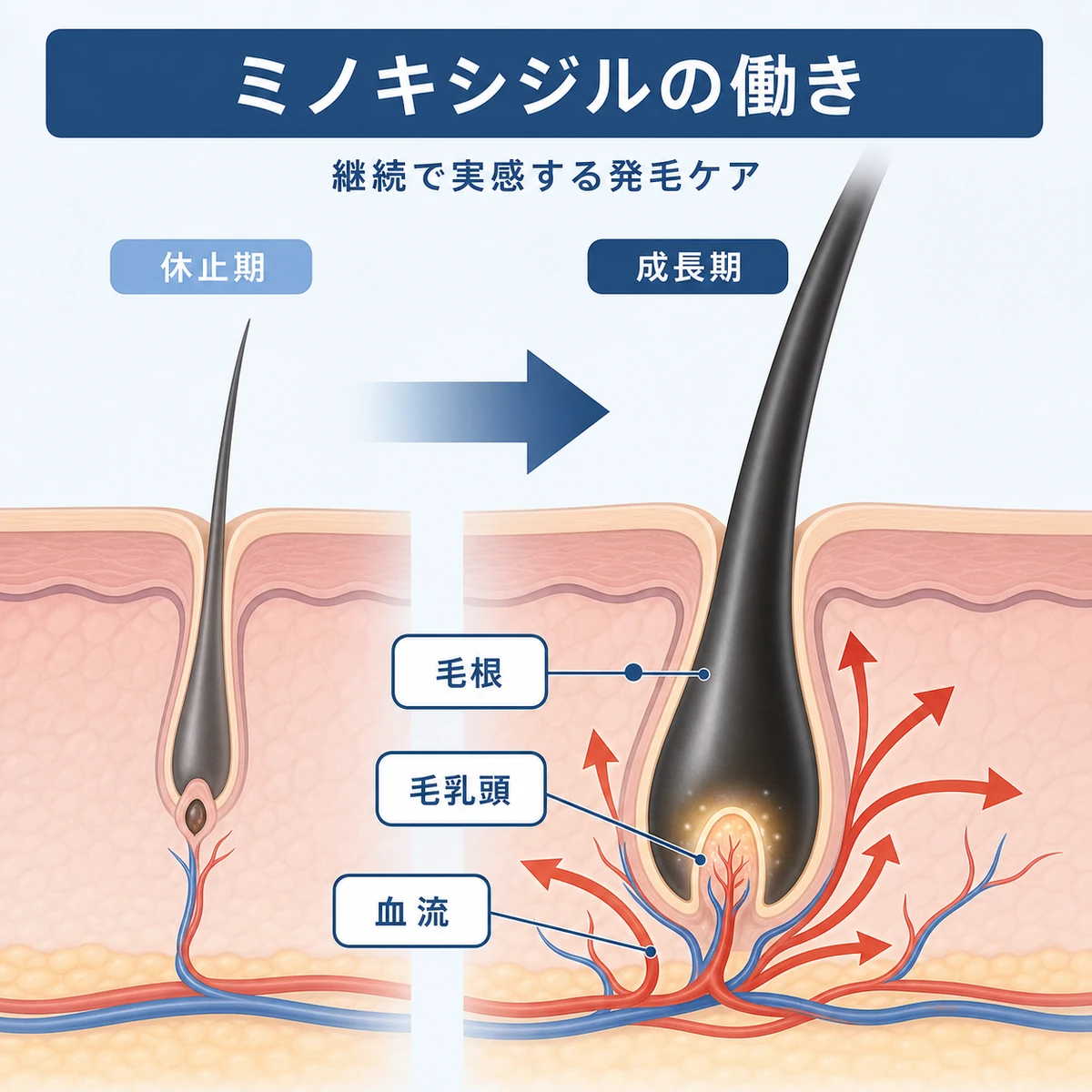 ミノキシジルが毛根の血流を高め休止期から成長期へ移行させる仕組みを表した頭皮断面の医療イラスト