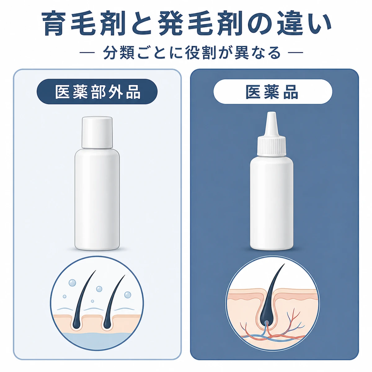 医薬部外品の育毛剤と医薬品の発毛剤の違いを対比した医療イラスト
