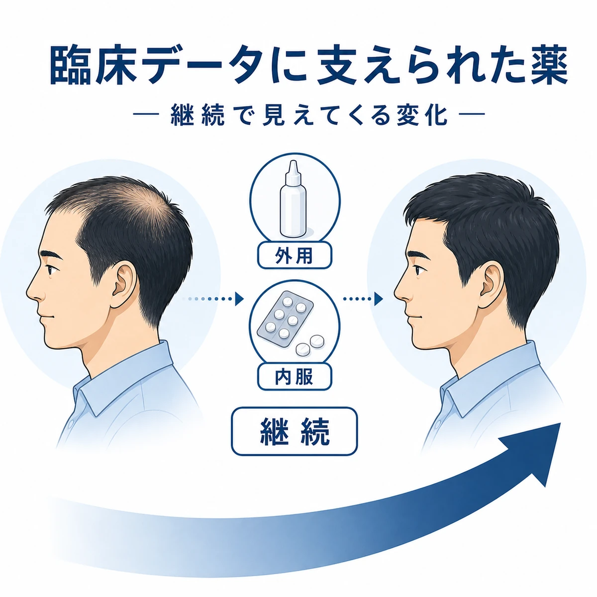 薄毛治療薬の効果を支える臨床データと継続の流れを表した医療イラスト