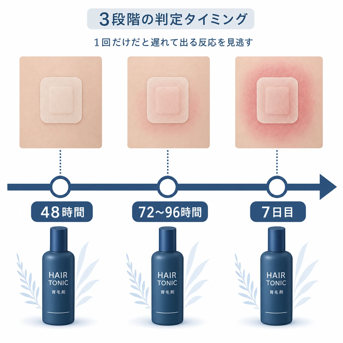 パッチテストを48時間・72〜96時間・7日目の3段階で判定する流れを表した医療イラスト